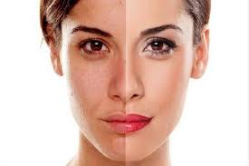 Bulu mata baru anda dapat bertahan dari beberapa minggu hingga dua bulan, dan akan jatuh mengikuti bulu mata alami yang rontok. 4 Manfaat Buah Rambutan Untuk Kecantikan Penasaran