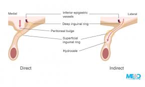 ka_3508 groin diagram female schematic wiring. How To Examine The Inguinal Region Medmastery