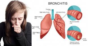 Pin On Chronic Fatigue Help