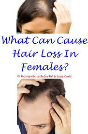 Pin On Hair Loss Help
