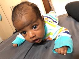 Coconut oil is a natural ingredient that can be used to achieve several benefits for your baby. Coconut Oil Bad For Babies Hair July 2018 Babies Forums What To Expect