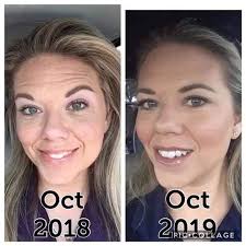 Holistic Beauty and Anti-Aging Alternatives in Vancouver