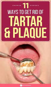 How To Remove Tartar And Plaque From Teeth 11 Home Remedies Teeth Health Oral Health Care Health And Wellbeing