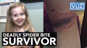 You meet a woman who tells you that she teaches english. Girl Hospitalized After Black Widow Spider Bite