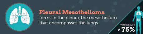 Practitioners dealing with mpm patients should be aware that legal . Types Of Mesothelioma The Williams Law Firm Firm