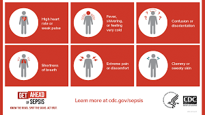 Image result for Sepsis