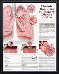 chronic obstructive pulmonary disease copd chart 20x26