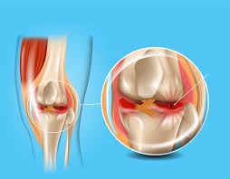Maybe you would like to learn more about one of these? How To Sleep After Meniscus Surgery Pillow Insider
