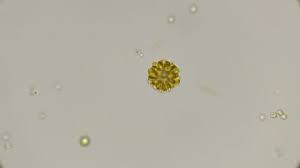 We did not find results for: Cell Of Algae Dunaliella Salina Stock Footage Video 100 Royalty Free 18728990 Shutterstock
