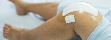 What Can I Do After Knee Replacement Surgery When To Return To Normal Activity New Mexico Orthopaedic Associates P C