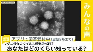 TBS NEWS DIG - News update