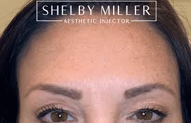 Results last between three and four months. Botox And Dysport Lehi Ut Anti Aging Treatment Ruma Aesthetics