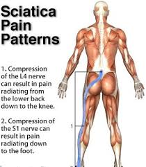 Pin On Ankylosing Spondylitis