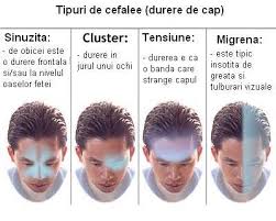 Totul Despre Durerea De Cap Ce Afectiuni Poate Ascunde Si Modalitati De Ameliorare Durerile De Cap Pot Avea Cauze Usoare Dar Pot Ascunde Si Afectiuni Grave Cand Reprezinta Un Motiv De