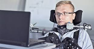 В партнерстве с als association. What Causes Als Who Gets It And What Are The Symptoms