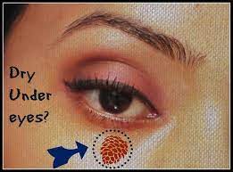 Tips To Get Rid Of Dry Skin Around Eyes Dry Skin Around Eyes Dry Under Eyes Deep Wrinkles