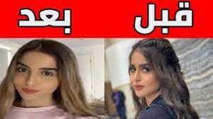 حلا شيحة نشرت عبر خاصية ستوريز على انستقرام فيديو لها، من صالون التجميل بعد أن قصت شعرها قليلاً وأخذت تستعرض خصلاتها أمام الكاميرا، مع حرصها على توجيه شكر خاص لمصفف الشعر. Ø´Ø§Ù‡Ø¯ ÙƒÙŠÙ Ø£ØµØ¨Ø­Øª Ø­Ù„Ø§ Ø§Ù„ØªØ±Ùƒ Ø¨Ø¹Ø¯ Ø¹Ù…Ù„ÙŠØ§Øª Ø§Ù„ØªØ¬Ù…ÙŠÙ„ Youtube