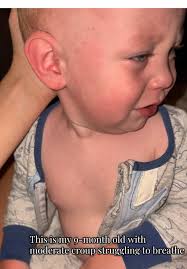 Belly Breathing in 9 Month Old