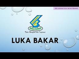 Luka bakar inhalasi adalah luka bakar yang disebabkan oleh terhirupnya gas yang panas, cairan panas atau produk berbahaya dari proses pembakaran hasil pengkajian: Latihan Soal Ukom Perawat Luka Bakar Pelajari Trik Cara Menghitung Luas Luka Bakar Youtube
