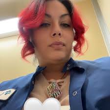 How to get rid of dark spots and scars