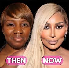 Look how Alessia has changed! If you want a similar change, type “Nose” to  get a quote!