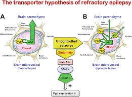 Will this virgin be able to keep up with his experienced partner? Epilepsy And Alterations Of The Blood Brain Barrier Cause Or Consequence Of Epileptic Seizures Or Both Springerlink