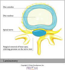 16795 county road 24, ste 120 plymouth, minnesota. University Orthopedics Surgical Options Providence Rhode Island