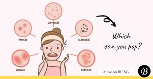 It is caused by clogged pores on the skin, certain face or eye creams. 6 Types Of Pimples That Should Should Not Be Extracted In A Facial