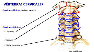 Cuando el cuello duele, es posible que usted tenga dificultad para moverlo, especialmente girarlo hacia un lado. Columna Vertebral 3 Vertebras Cervicales Dorsales Y Lumbares Vertebra Cervical Anatomia Humana Musculos Lumbares