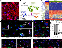 We did not find results for: Capillary Cell Type Specialization In The Alveolus Nature
