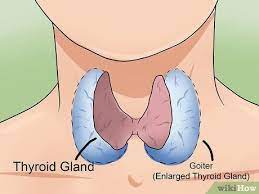 Bildtitel Heal Your Thyroid Naturally Step 17 Gesundheit Heilen Schilddruse