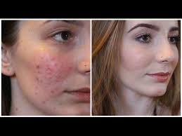 School Dance Performance