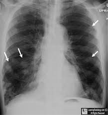 Pin On Medicina Humana