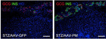 The following chart outlines normal blood sugar ranges for people. Gene Therapy Restores Normal Blood Glucose Levels In Mice With Type 1 Diabetes Eurekalert Science News