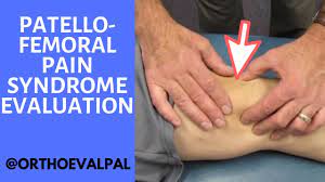 Patellofemoral Pain Syndrome Evaluation And Treatment Youtube
