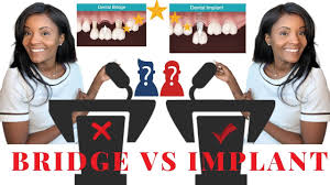 Dental implants for seniors can be an important part of dental health. Dental Implants Costs Procedures And Types In The Us