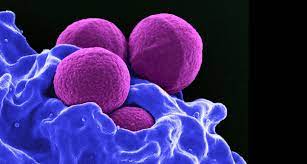 But because it takes about 48 hours for the bacteria to grow, newer tests that can detect staph dna in a matter of hours are now becoming more widely available. Mrsa Alternative Zu Antibiotika Konnte Gegen Staphylokokken Wirken