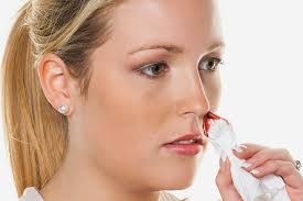 bleeding nose