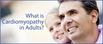 Image result for Cardiomyopathy