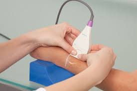 Image result for Probe-to-Bone Test