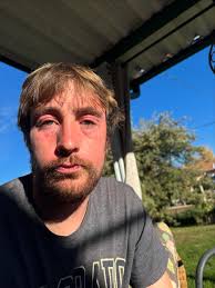 Well, vacation is over and I'm coming home with a bruised nose, a black  eye, and a bee sting