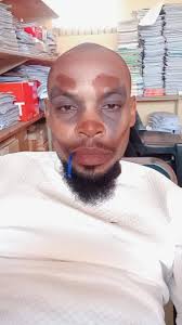 Hi i replaced my m52tub28 to m54b30 do i need to replace the ecu ,injectors  and maf