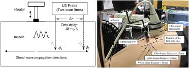 Diagram Of The Vibro Ultrasound System For Shear Wave