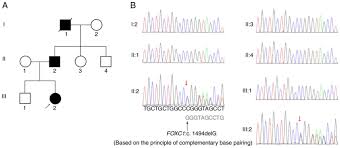 A Novel Mutation Of Foxc1 In A Chinese Family With Axenfeld