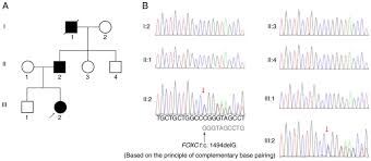 a novel mutation of foxc1 in a chinese family with axenfeld