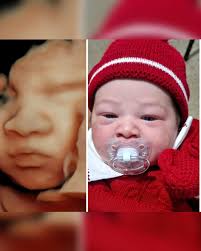 Antes e depois… de um mesmo amor. 💛 A gente sabe que é o mesmo bebê, mas é  impossível não se emocionar ao ver como aquele rostinho que conhecemos  ainda dentro da