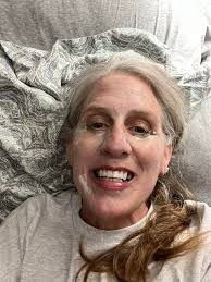 Face Serum for Restoring Skin Bounce with Daily SPF