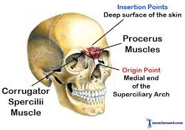 Pin On Headaches
