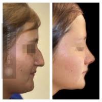 60+ perfiles de «Kimura»