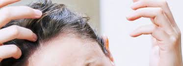 Alopecia areata, telogen effluvium, and trichotillomania. Can Mineral Imbalance Cause Hair Loss Hair Transplant Dubai